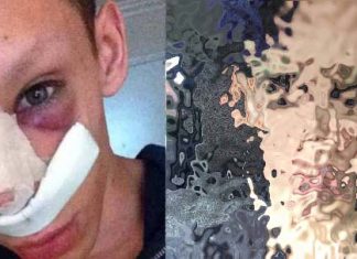 Esse homem gastou uma quantia enorme em plásticas para parecer um alien
