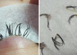 Seu maior desejo era colocar cílios postiços, mas isso se tornou seu pior pesadelo