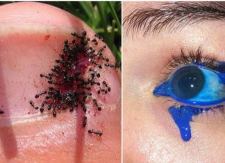 15 imagens desconfortáveis que vão te causar aquele arrepio na espinha
