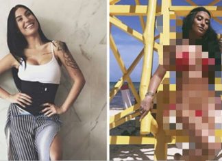 A lipo da Bia mostra que quem vê instagram não vê vida real