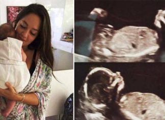 Mãe dá à luz e começa a se sentir estranha. Um mês depois, o ultrassom revela algo chocante