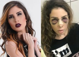 Empresário de Camilla Uckers divulga nota revelando temer a morte da youtuber: “Já não vejo mais solução”