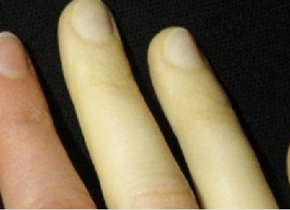 Seis sinais do seu corpo que você não deve ignorar