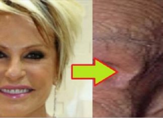 Ana Maria Braga é flagrada sem maquiagem e pele ‘assusta’; veja