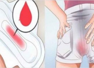 4 tipos de menstruação que as mulheres devem ter cuidado